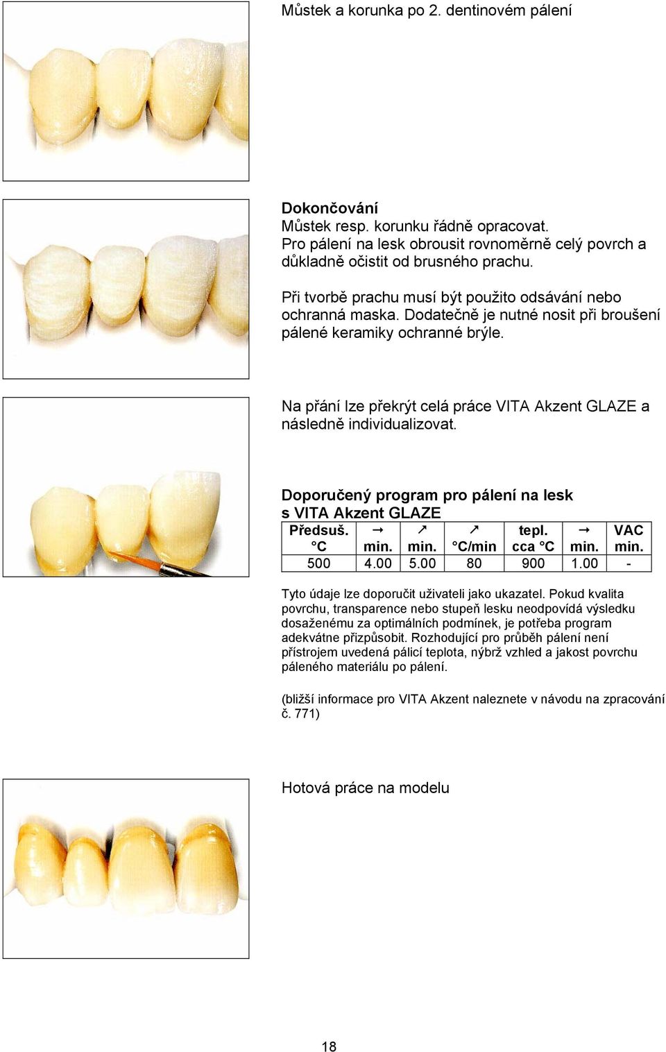 Na přání lze překrýt celá práce VITA Akzent GLAZE a následně individualizovat. Doporučený program pro pálení na lesk s VITA Akzent GLAZE Předsuš. C C/min tepl. cca C VAC 500 4.00 5.00 80 900 1.