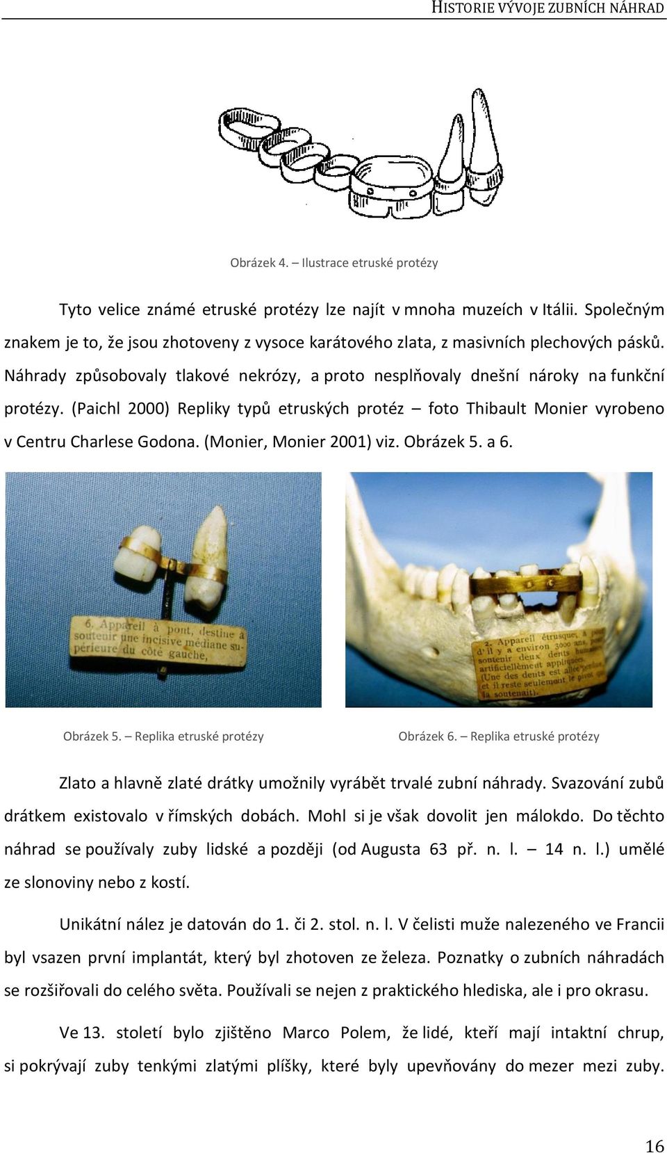 (Paichl 2000) Repliky typů etruských protéz foto Thibault Monier vyrobeno v Centru Charlese Godona. (Monier, Monier 2001) viz. Obrázek 5. a 6. Obrázek 5. Replika etruské protézy Obrázek 6.