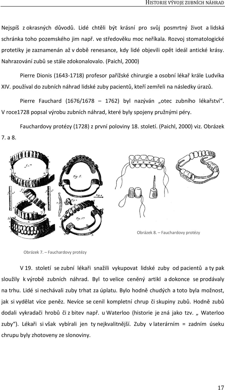 (Paichl, 2000) Pierre Dionis (1643-1718) profesor pařížské chirurgie a osobní lékař krále Ludvíka XIV. používal do zubních náhrad lidské zuby pacientů, kteří zemřeli na následky úrazů.