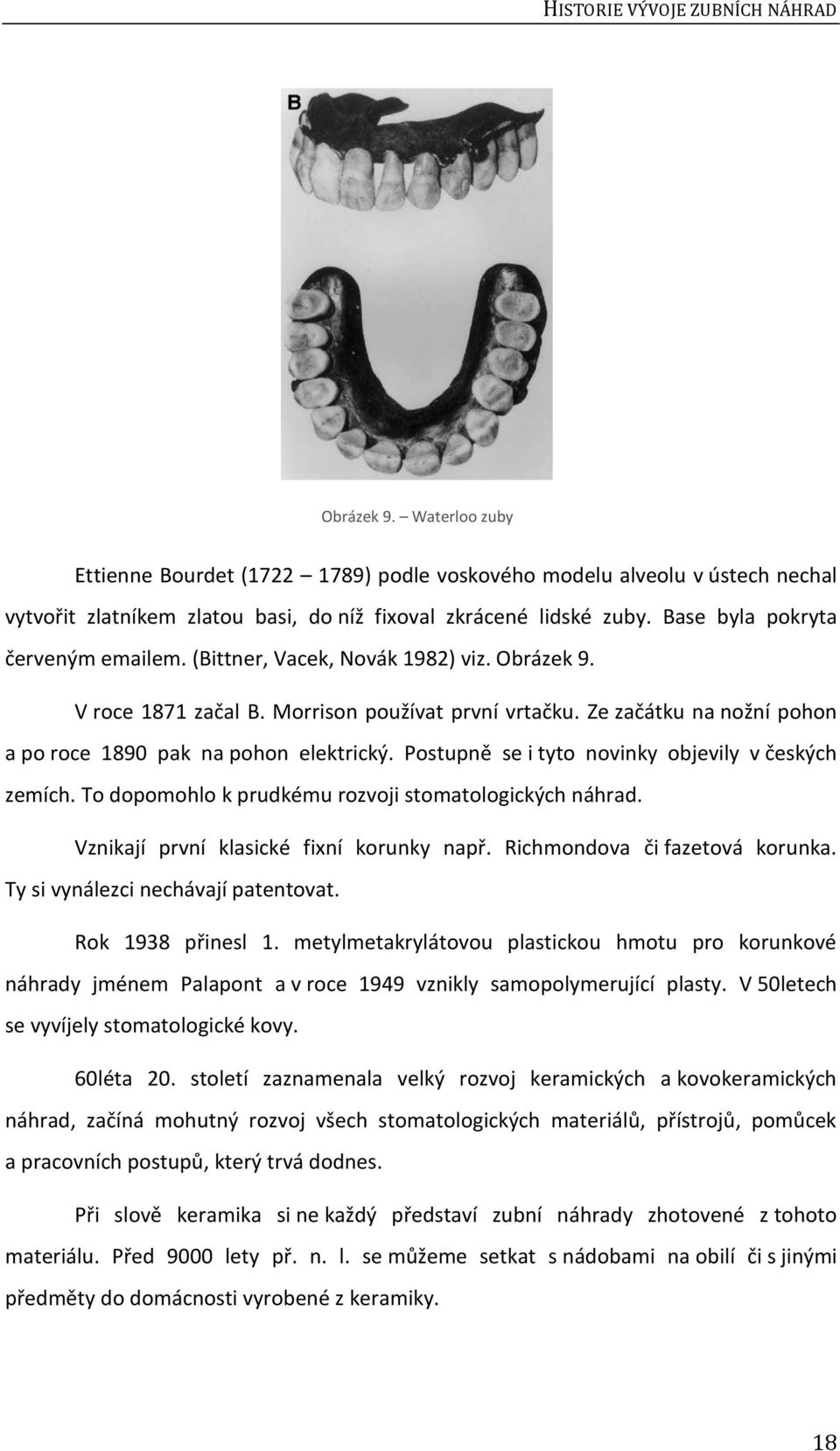 Postupně se i tyto novinky objevily v českých zemích. To dopomohlo k prudkému rozvoji stomatologických náhrad. Vznikají první klasické fixní korunky např. Richmondova či fazetová korunka.