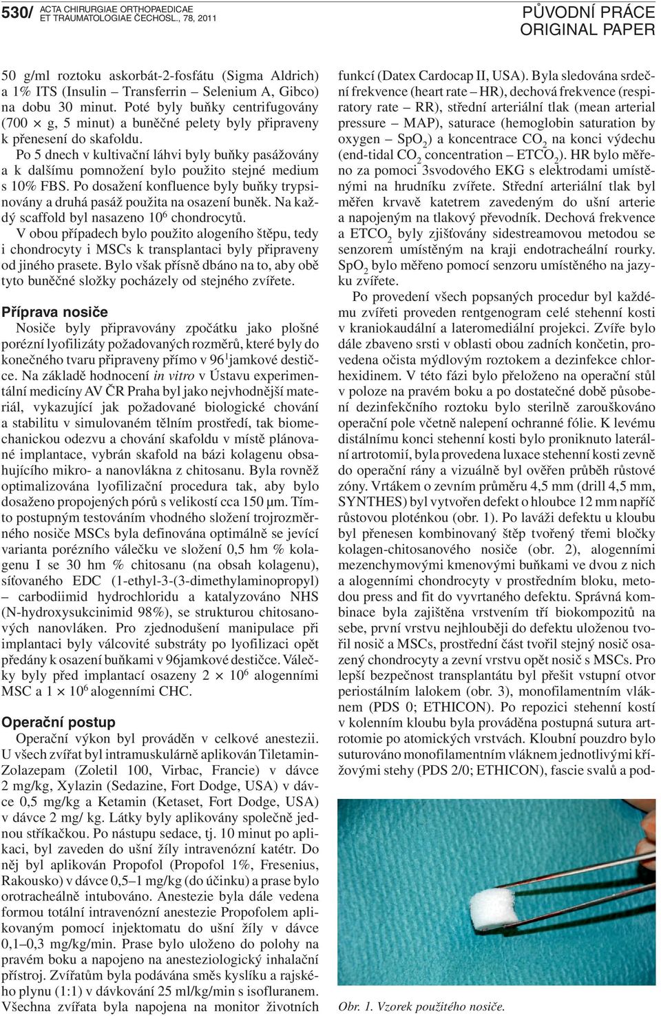 Po 5 dnech v kultivační láhvi byly buňky pasážovány a k dalšímu pomnožení bylo použito stejné medium s % FBS. Po dosažení konfluence byly buňky trypsinovány a druhá pasáž použita na osazení buněk.