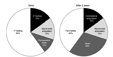 Osud pacientů po amputaci pod kolenem zhojí se 75% (15% p.s.) 15% amputace nad kolenem 10%