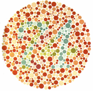 barvoslepost (daltonismus) - porucha barevného vidění, neschopnost rozlišit červenou a zelenou barvu zelený zákal (glaukom) - zvýšení nitroočního tlaku poškození