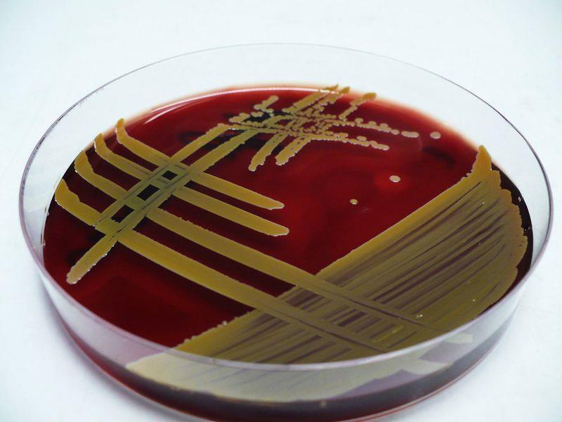 Charakteristika Staphylococcus aureus Zlatý stafylokok nejvýznamnější druh rodu Staphylococcus (čeleď