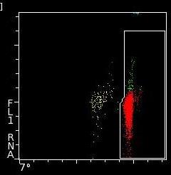 ------ Hypochromic--- - Erytrogram ------ Macrocytic------ -------- Červené tečky: RBC