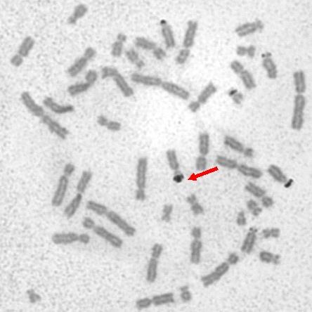 NOR barvení chromosomů navázání zrn stříbra na aktivní oblast organizátoru jadérka (sekundární konstrikce akrocentrických chromosomů) stříbro se vyloučí z AgNO3 za vyšší teploty a v kyselém prostředí