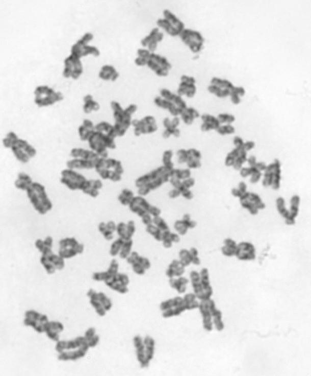 3) ZÍSKANÉ CHROMOSOMOVÉ ABERACE (vznik v souvislosti s