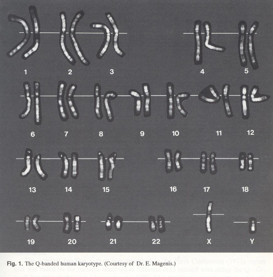 Q - pruhování chromosomů barvení akridinovými deriváty (fluoreskující látky fluorochromy), akridin se specificky váže na oblasti bohaté na adenin (A) a tymin (T) Q - pruhy