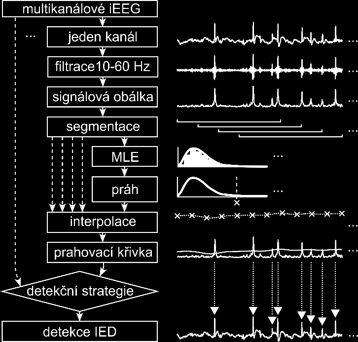 Ing. Radek Janča Analýza intrakraniálních EEG signálů v epileptologii Přesné časové značky výbojů byly posléze korigovány a sjednoceny na nejbližší maximum signálové obálky ve sto milisekundovém