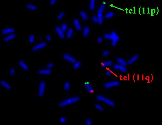 METODY MOLEKULÁRNÍ CYTOGENETIKY FISH (preparáty k hodnocení) na chromosomy v
