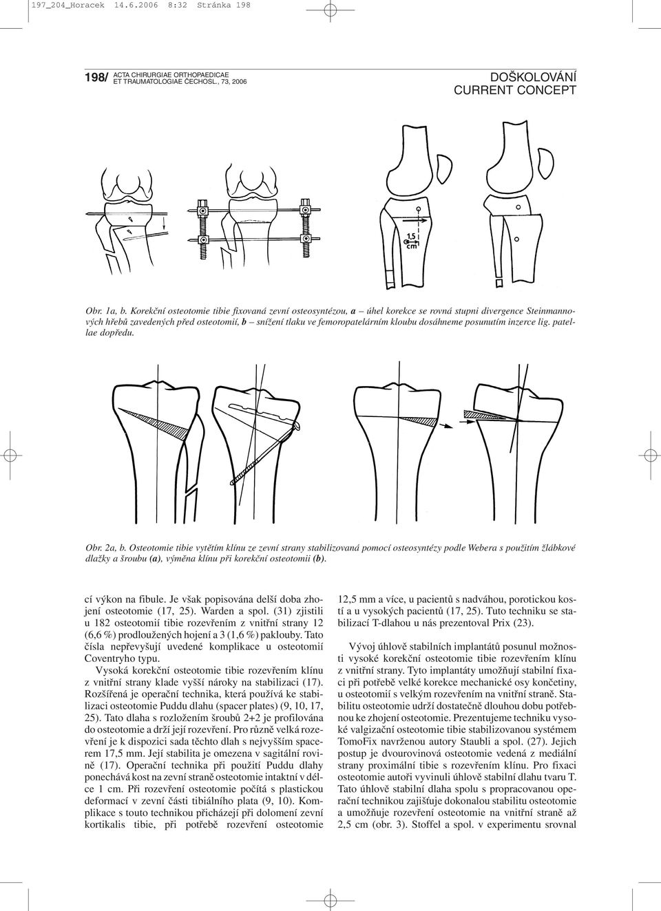 posunutím inzerce lig. patellae dopředu. Obr. 2a, b.