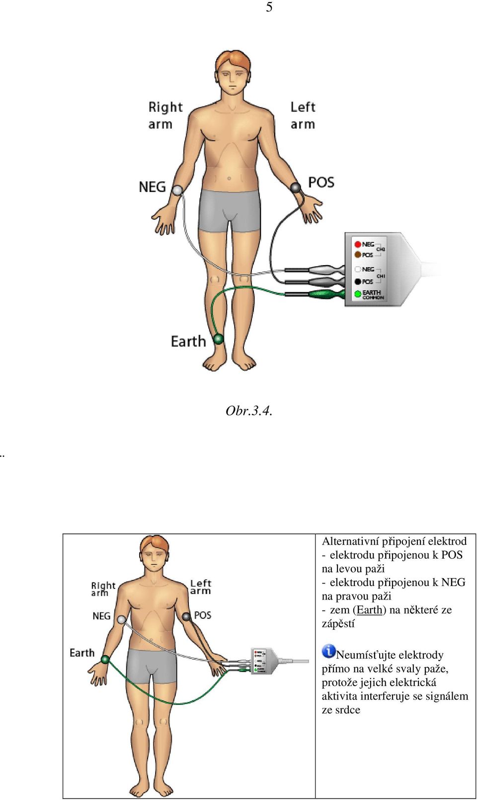 paži - elektrodu připojenou k NEG na pravou paži - zem (Earth) na