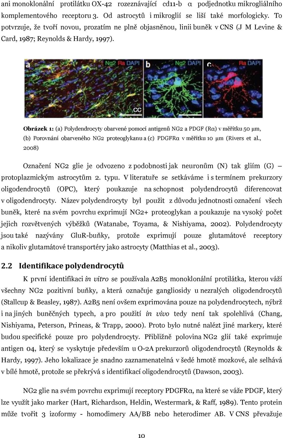 c Obrázek 1: (a) Polydendrocyty obarvené pomocí antigenů NG2 a PDGF (Rα) v měřítku 50 μm, (b) Porovnání obarveného NG2 proteoglykanu a (c) PDGFRα v měřítku 10 μm (Rivers et al.