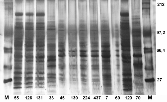 UTB ve Zlíně, Fakulta technologická 57 8.3 Proteinový profil analyzovaných streptokoků Analýza proteinů byla provedena metodou SDS PAGE PAGE s následnou fixací proteinů dusičnanem stříbrným.