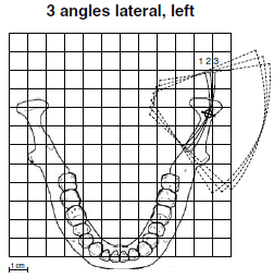 Laterální při 3 úhlech: Snímek pravého anebo levého TMJ kloubu při třech úhlech. Úhel pro snímek č.2 je nastavitelní (přednastavený úhel: 17 ±7 ).
