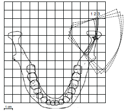 TMJ SNÍMKOVÁNÍ TMJ kloub Světlo určující pozici rentgenového paprsku se automaticky posune dozadu, do oblasti TMJ. Pozici můžete dostavit manuelně pomocí šipek, až je světlo na TMJ kloube.