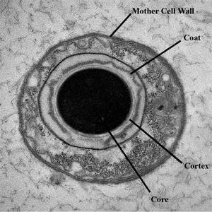 Obr. 9: Endospora, EM Obr.