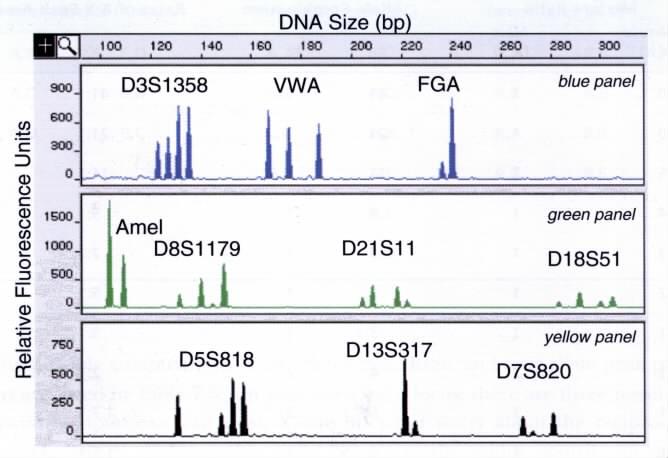 Příklady směsných vzorků Klasické profily, které je možné vidět ve směsných vzorcích běžných případů forenzní genetiky