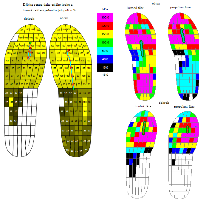 4.4.2 Popis distribuce tlaku a křivky centra tlaku na překážce ze 400 m tratě Křivka centra tlaku odrazu (obrázek 25) do překážky začíná ve středu oblasti střední nohy.