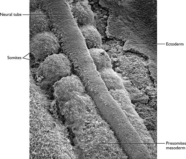 Paraxiální mesoderm