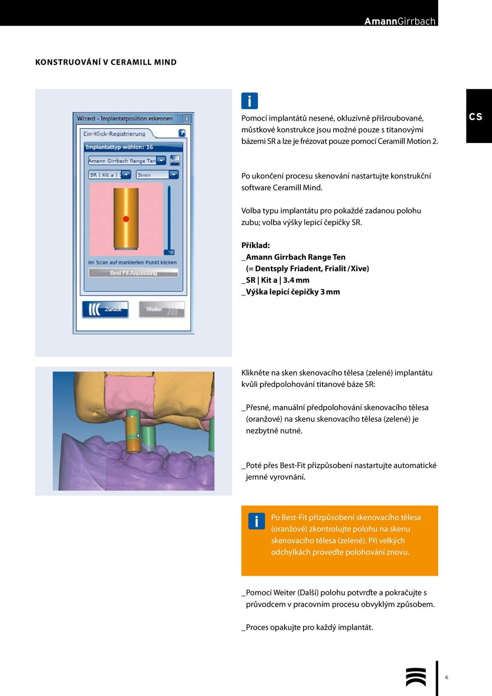 Příklad: _ Amann Girrbach Range Ten (= Dentsply Friadent, Frialit / Xive) _ SR Kit a 3.