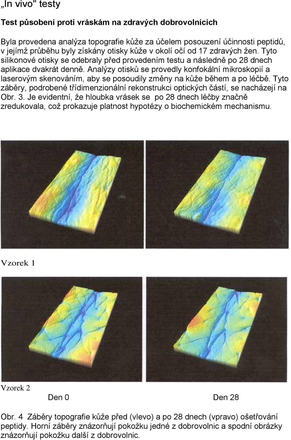 Analýzy otisků se provedly konfokální mikroskopií a laserovým skenováním, aby se posoudily změny na kůže během a po léčbě.