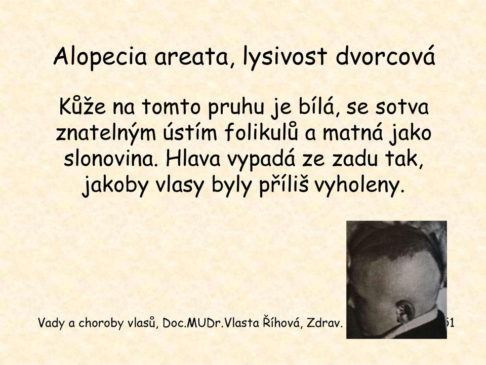 matná jako slonovina.