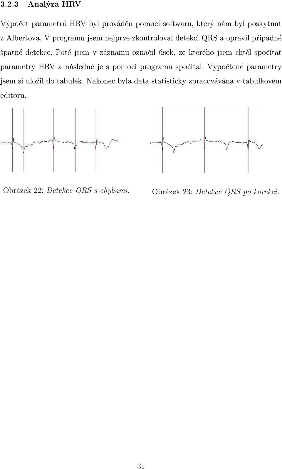 Poté jsem v záznamu označil úsek, ze kterého jsem chtěl spočítat parametry HRV a následně je s pomocí programu spočítal.