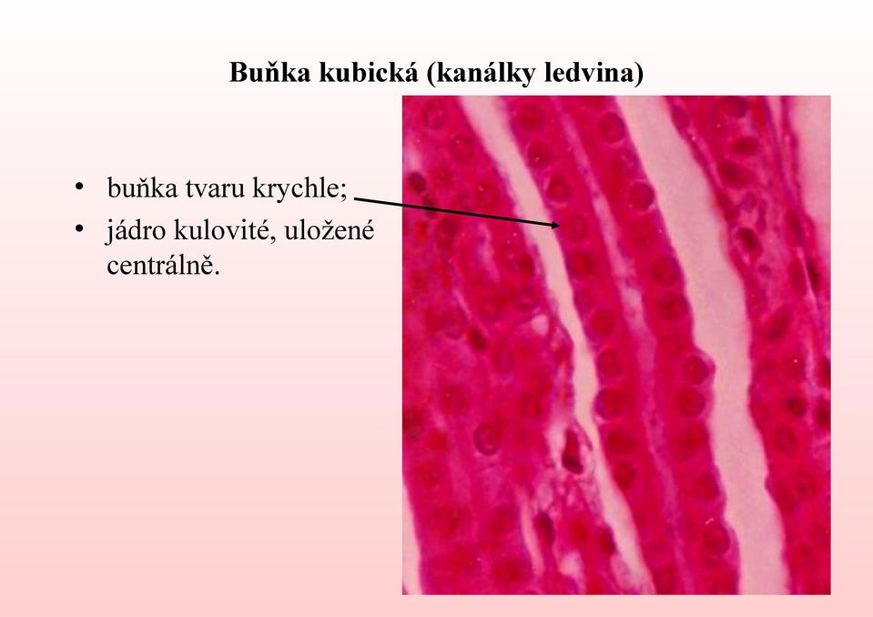 buňka tvaru krychle;