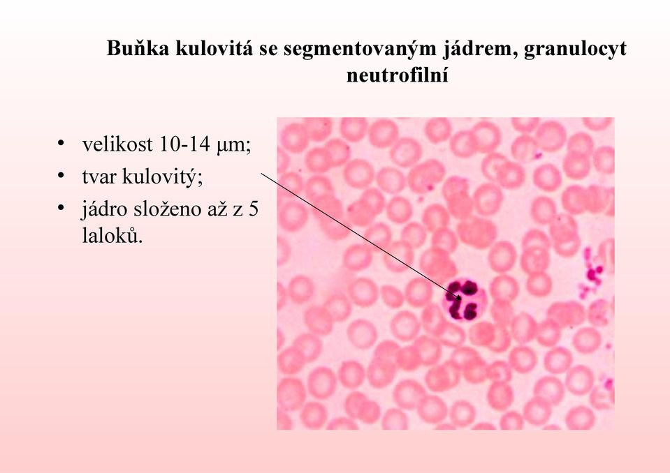 velikost 10-14 μm; tvar