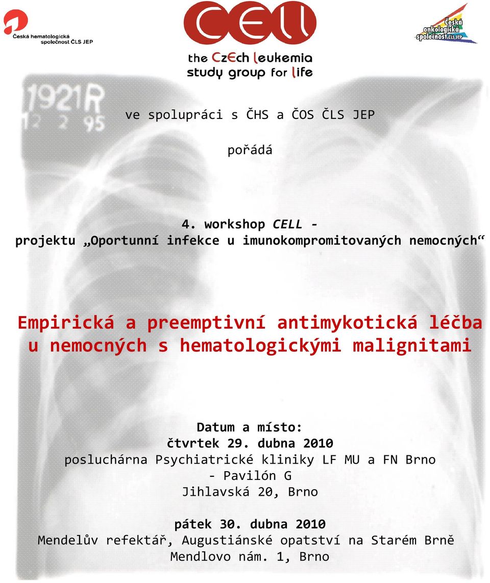 antimykotická léčba u nemocných s hematologickými malignitami Datum a místo: čtvrtek 29.