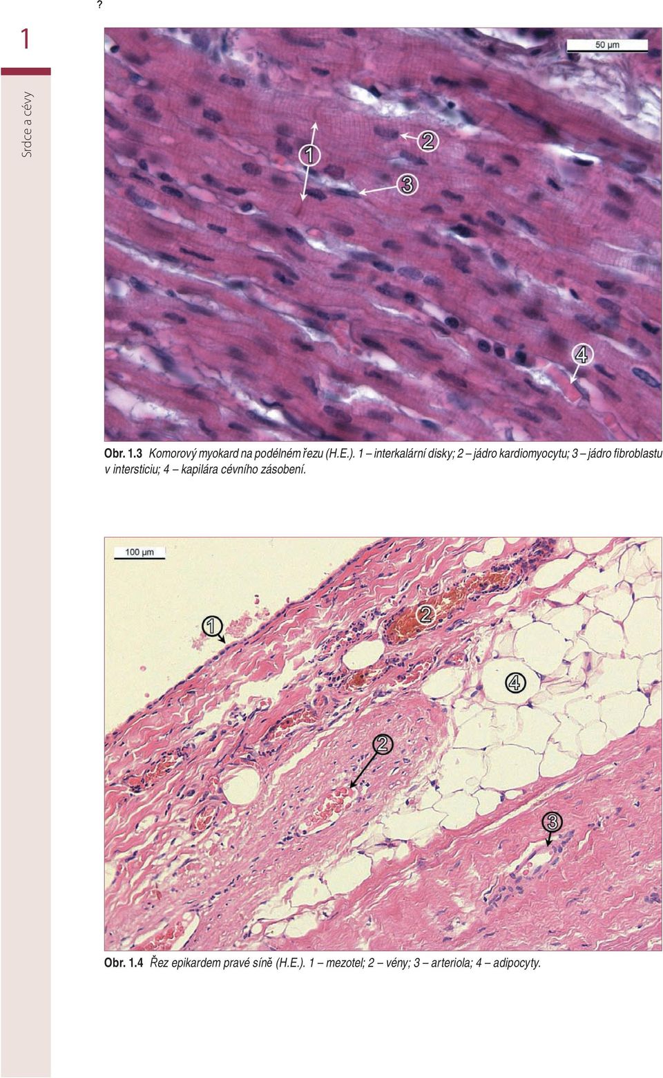 v intersticiu; 4 kapilára cévního zásobení. Obr. 1.