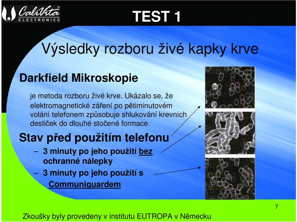 krevních destiček do dlouhé stočené formace.