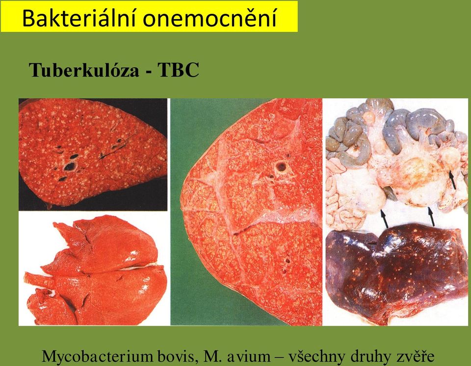 Mycobacterium bovis, M.