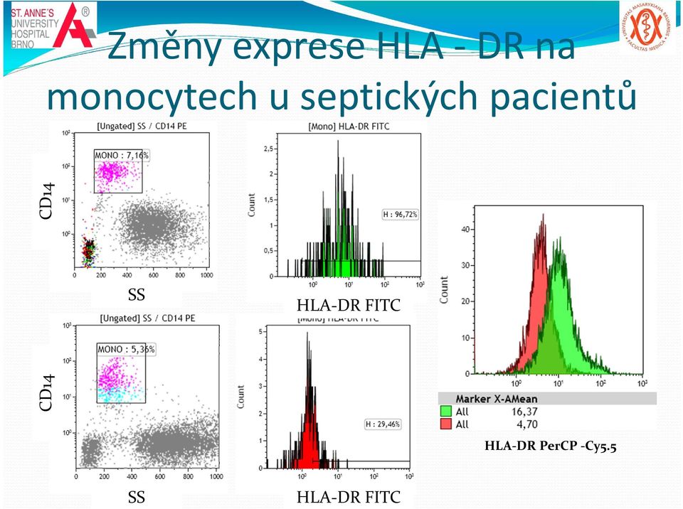 pacientů CD14 HLA DR FITC