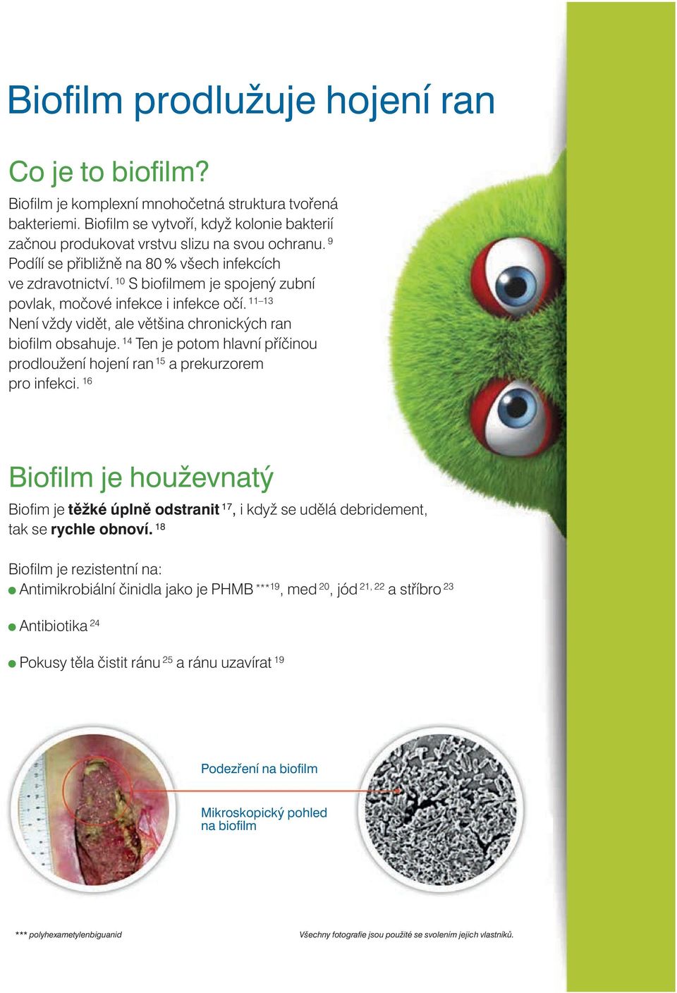 11 13 Není vždy vidět, ale většina chronických ran biofilm obsahuje. 14 Ten je potom hlavní příčinou prodloužení hojení ran 15 a prekurzorem pro infekci.
