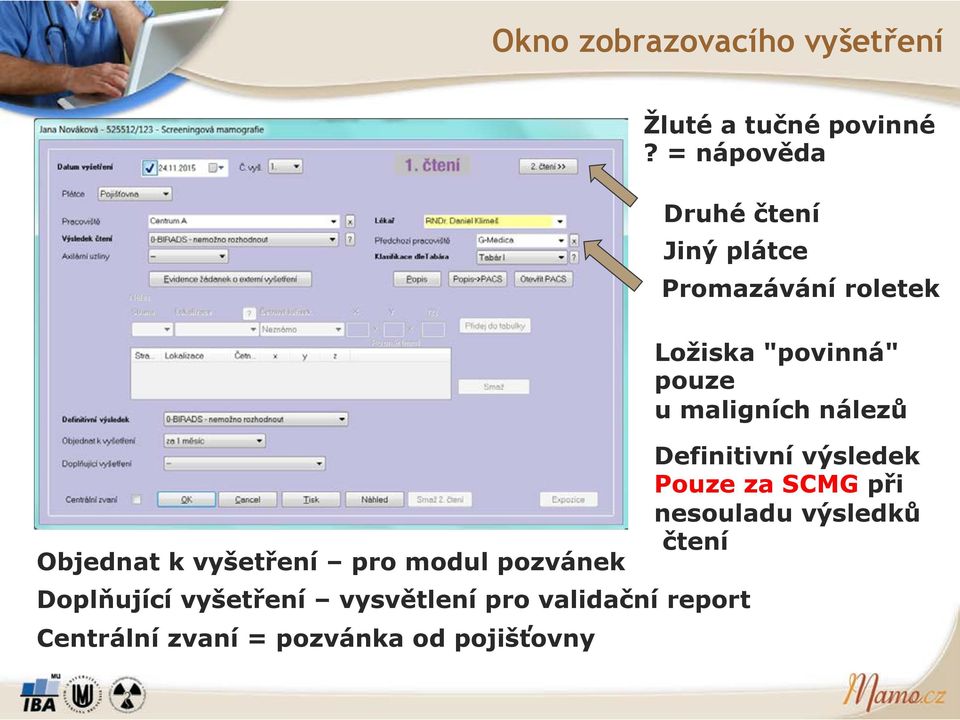 maligních nález# Definitivní v%sledek Pouze za SCMG p(i nesouladu v%sledk# 'tení