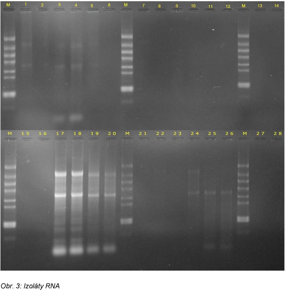 RNA