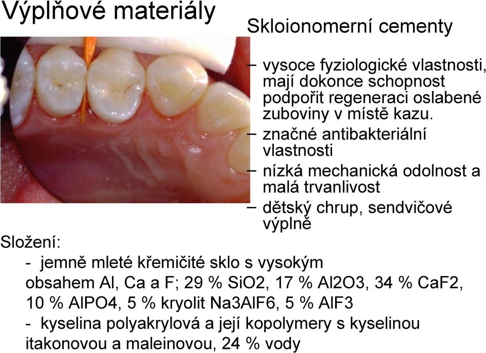 značné antibakteriální vlastnosti nízká mechanická odolnost a malá trvanlivost dětský chrup, sendvičové výplně Složení: -