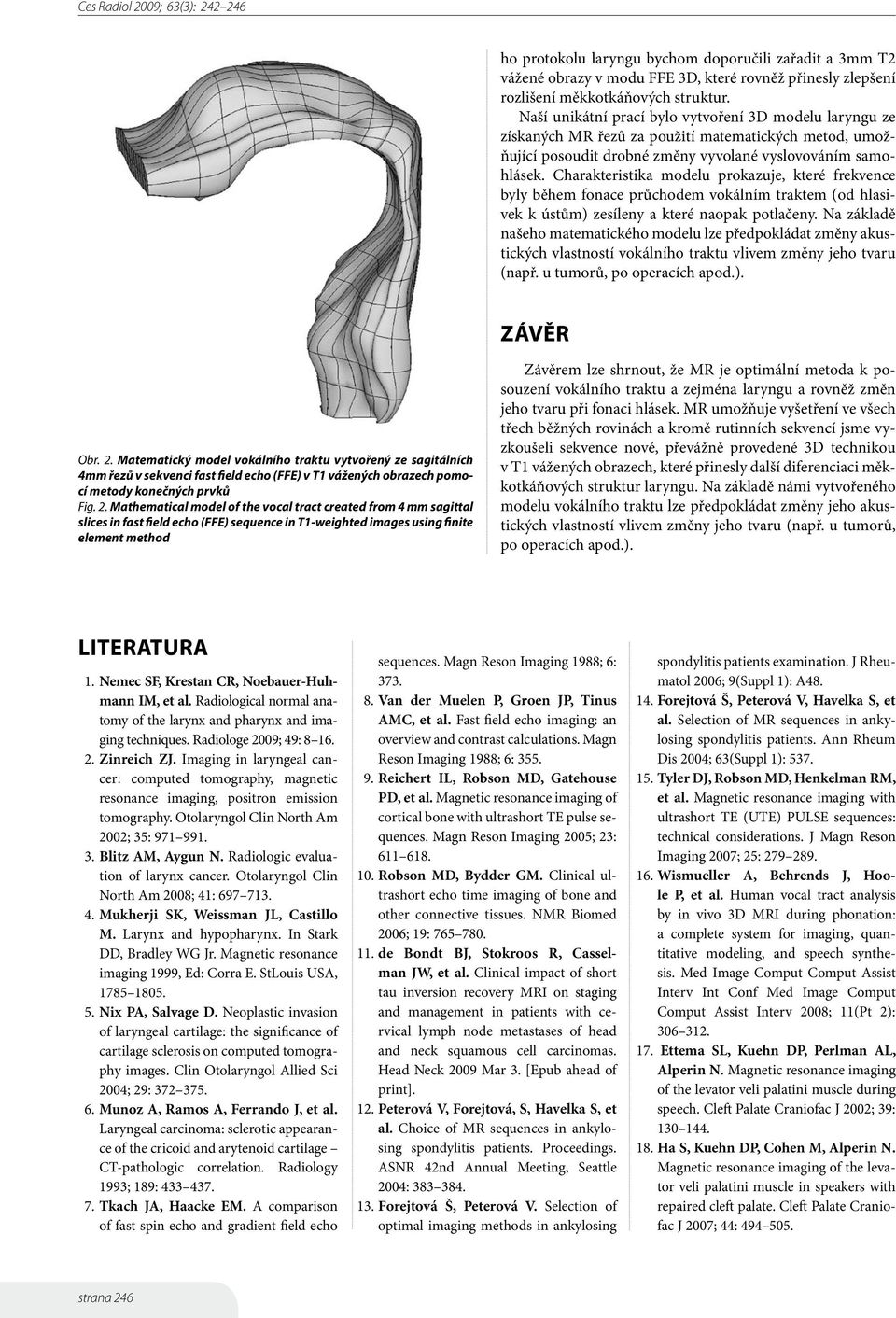 Charakteristika modelu prokazuje, které frekvence byly během fonace průchodem vokálním traktem (od hlasivek k ústům) zesíleny a které naopak potlačeny.