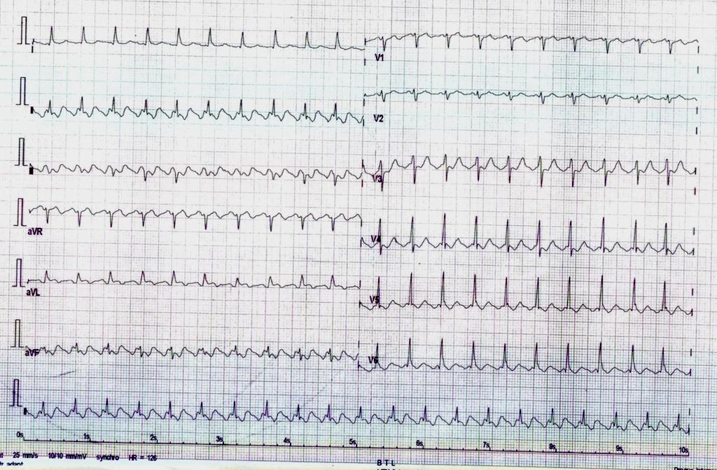 DG - ECG