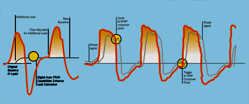 Average Volume Assured Pressure Support (AVAPS)