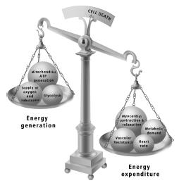 2 - Septic shock: Any chance of being more
