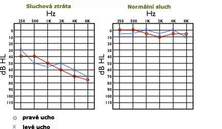 Něco málo o osobách se sluchovým postižením Pramen: http://www2.teiresias.muni.