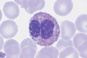 Eosinofilní granulocyty - Jádro segmentované na 2