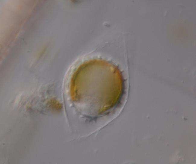 Cysty obvykle dosahují průměru 2-30 µm, vždy je na nich umístěn okrouhlý pór utěsněný organickou zátkou, která obsahuje křemík jen v omezeném množství nebo vůbec (Preisig 1994a).