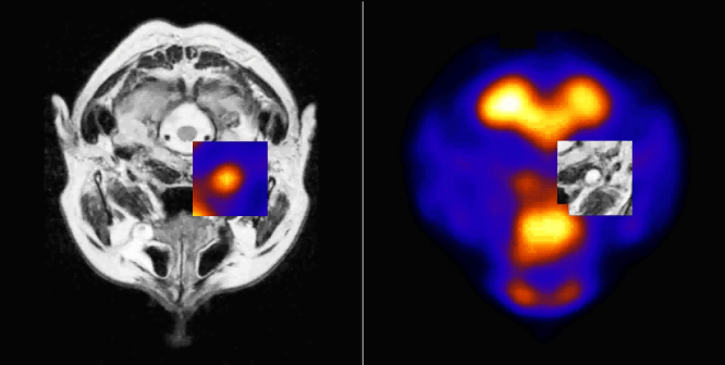 Fúze s MRI (upřesnění