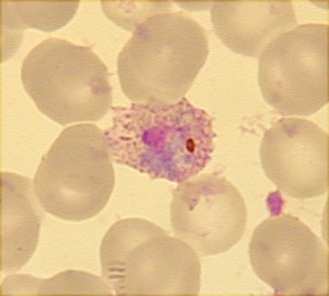 (gametocyty) nezvětšené Plasmodium vivax, P.