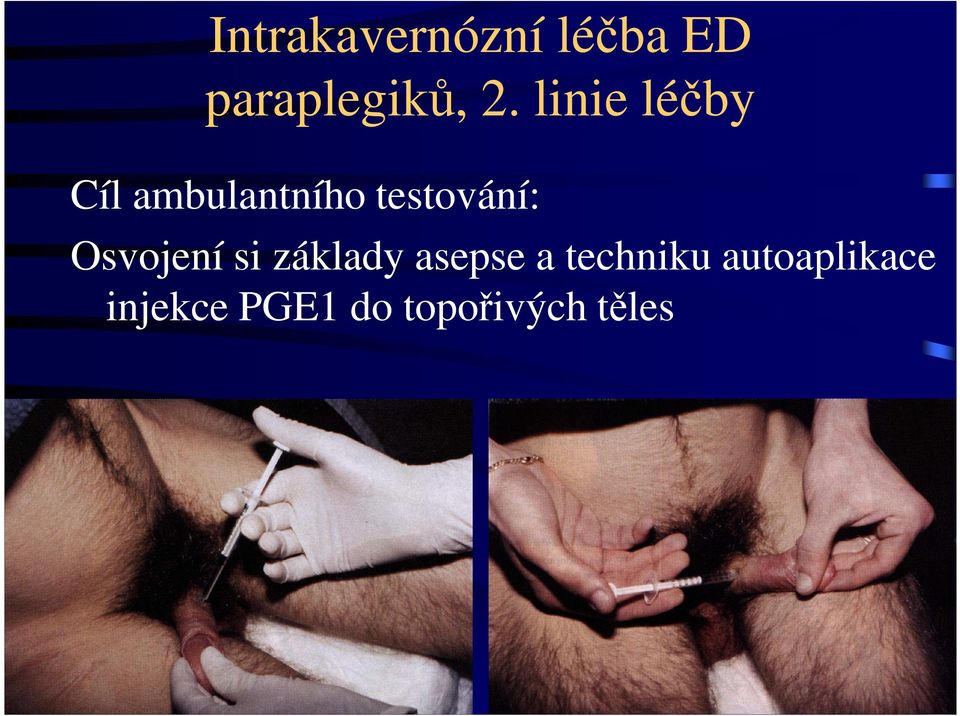 Osvojení si základy asepse a techniku