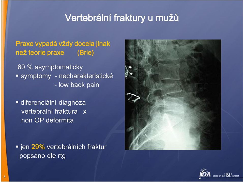 necharakteristické - low back pain diferenciální diagnóza